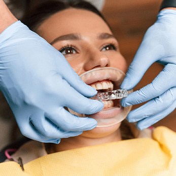 Dentist placing clear aligner on smiling patient