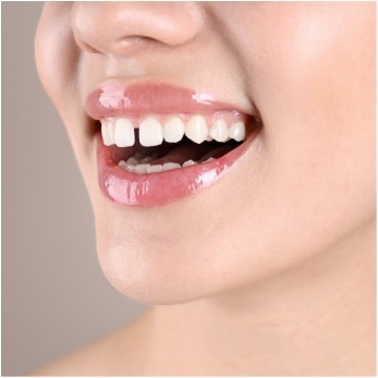 Up-close view of a gap between the upper front two teeth