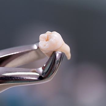 It may seem cheaper to extract a tooth instead of getting a root canal, but removing a natural tooth can end up costing a lot more